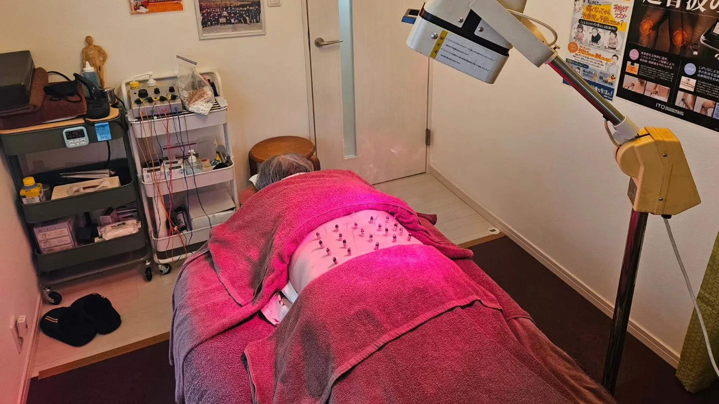 腰痛 鍼&お灸