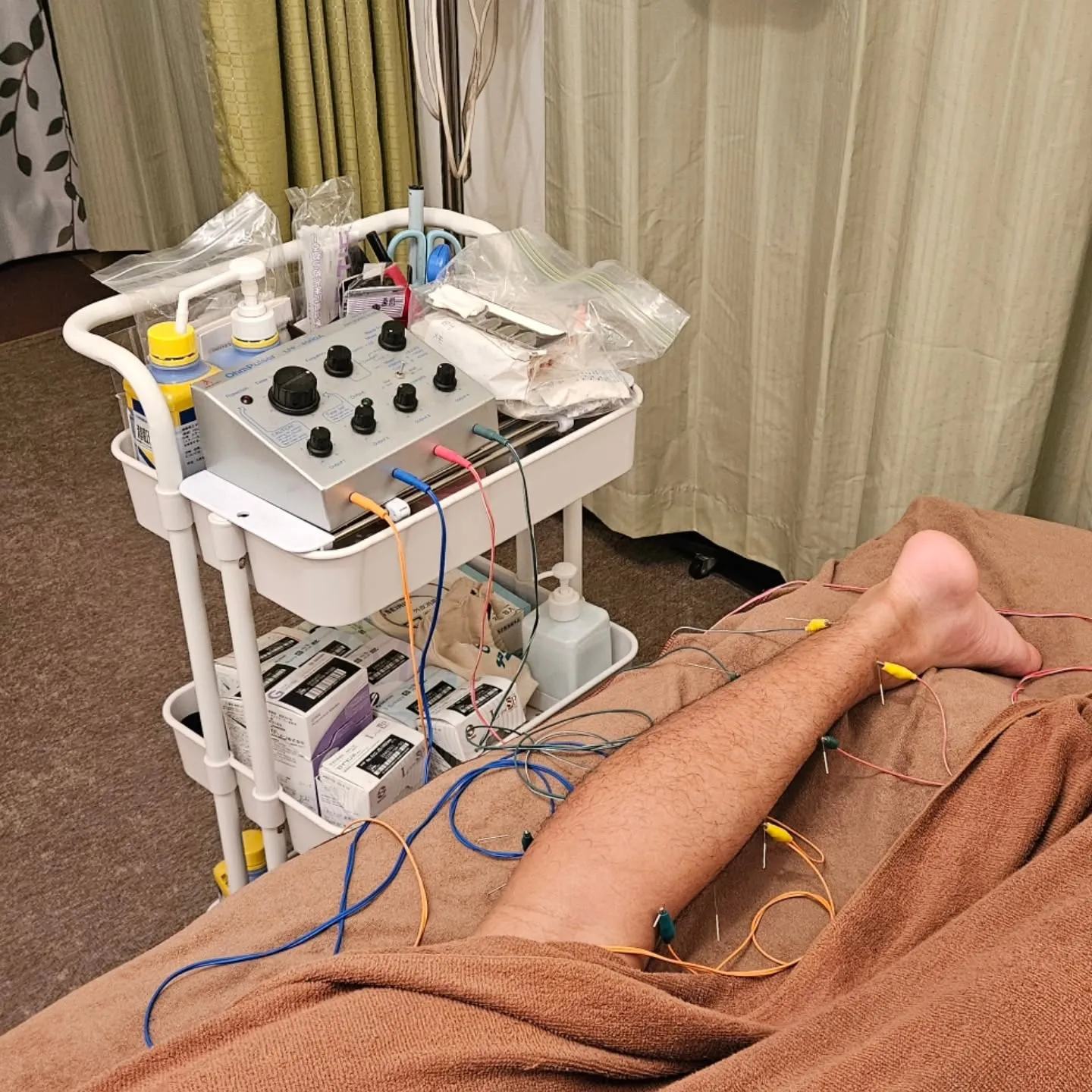 アキレス腱の痛み治療