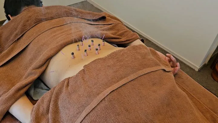 ぎっくり腰の治療